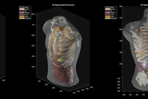 Midjourney's medical scanner video sparks skepticism over functionality