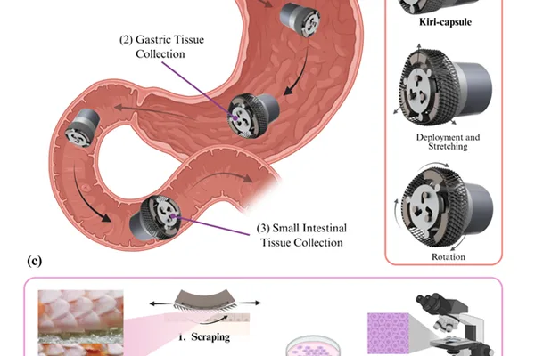 Robotic Capsule Performs Minimally Invasive GI Biopsies Using Kirigami Spikes