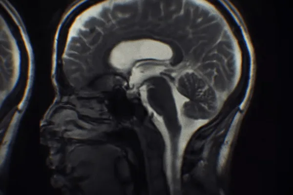 Experimental video player uses audioreactive MRI data