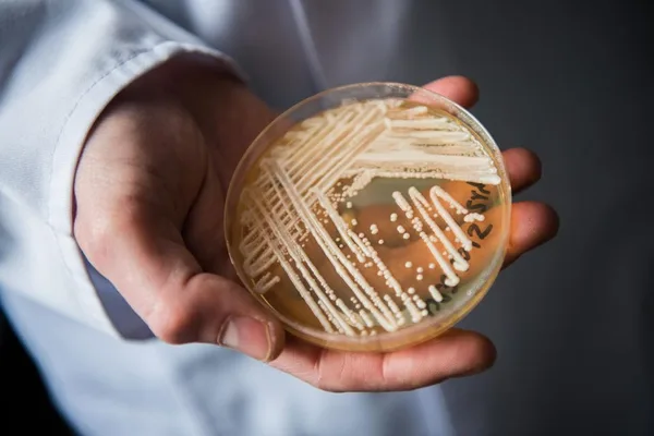 Drug-resistant fungus Candida auris surges in US hospitals
