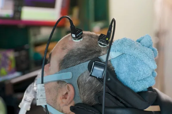 AI translates brain signals for ALS patient to work full-time