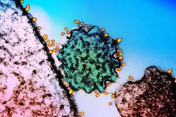 New two-antibody cocktail targets deadly Nipah and Hendra viruses