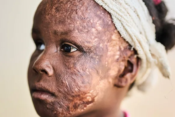 Amnesty International alleges RSF committed ethnic cleansing in Sudan