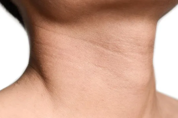 Evolutionary biologists explain Adam's apple as a signal of male dominance