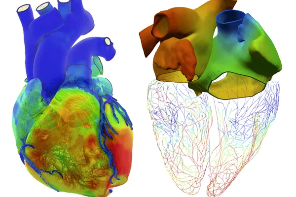 Virtual organ twins allow surgeons to practice complex procedures before operating