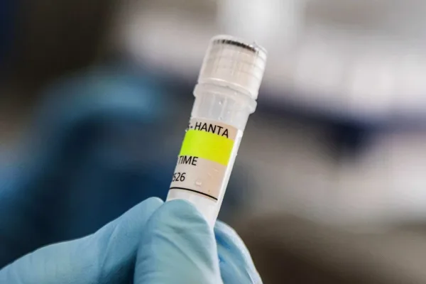 Hantavirus outbreak linked to cruise ship, officials downplay local risk